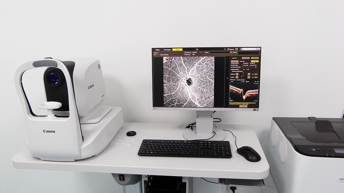 diagnosi precoce glaucoma