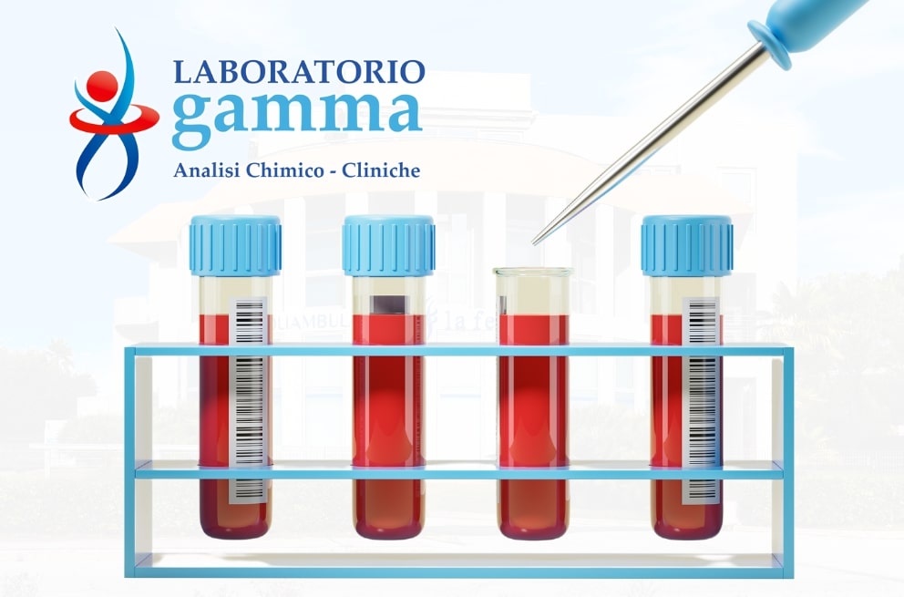 Punto prelievi a Civitanova Marche