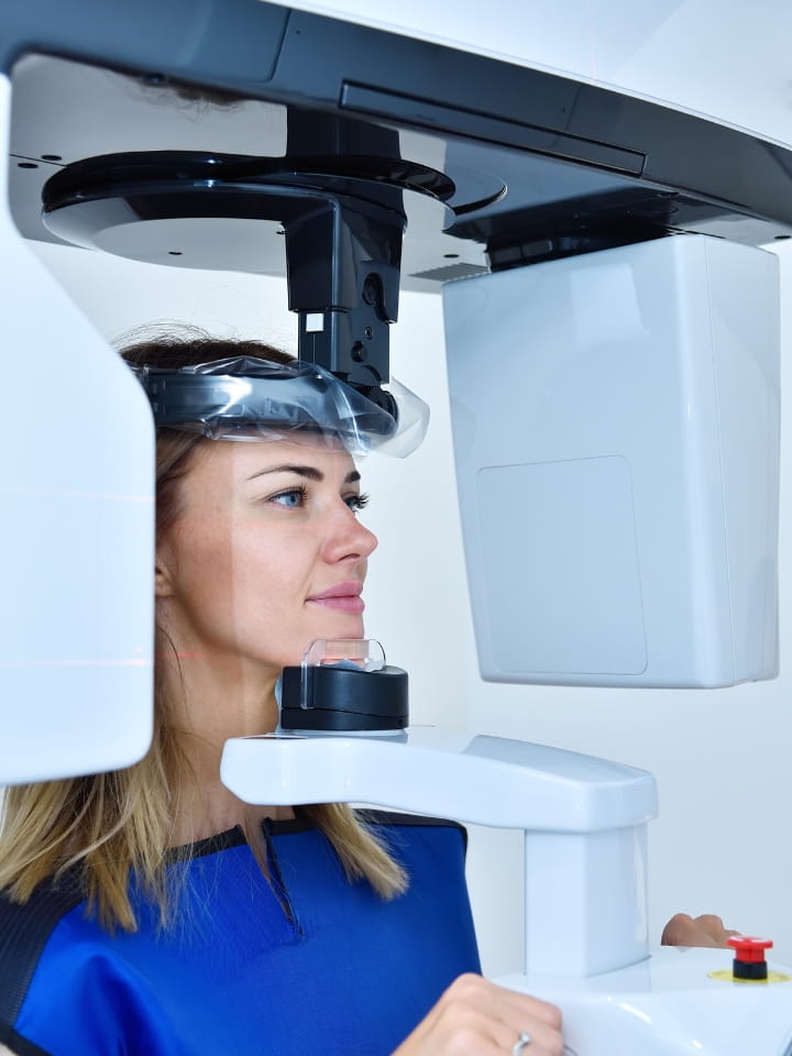 Cone Beam — TAC Dentale