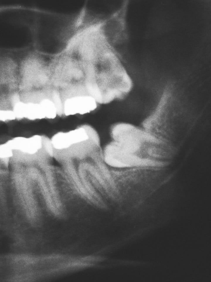 O.P.T. — Panoramica Dentale